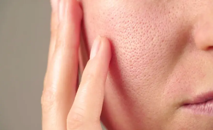 Pores dilatés, comment les rendre moins visibles ?
