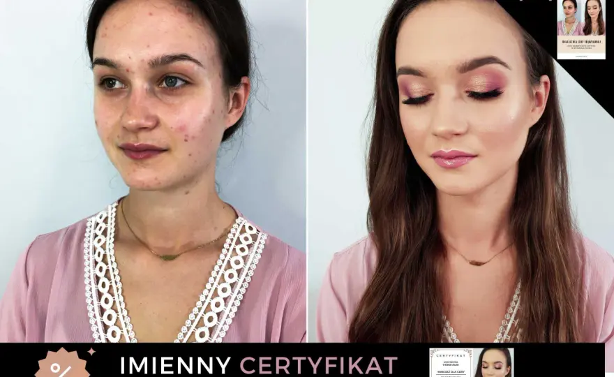 Makijaż cery trądzikowej - jak ukryć, nie pogarszając stanu?