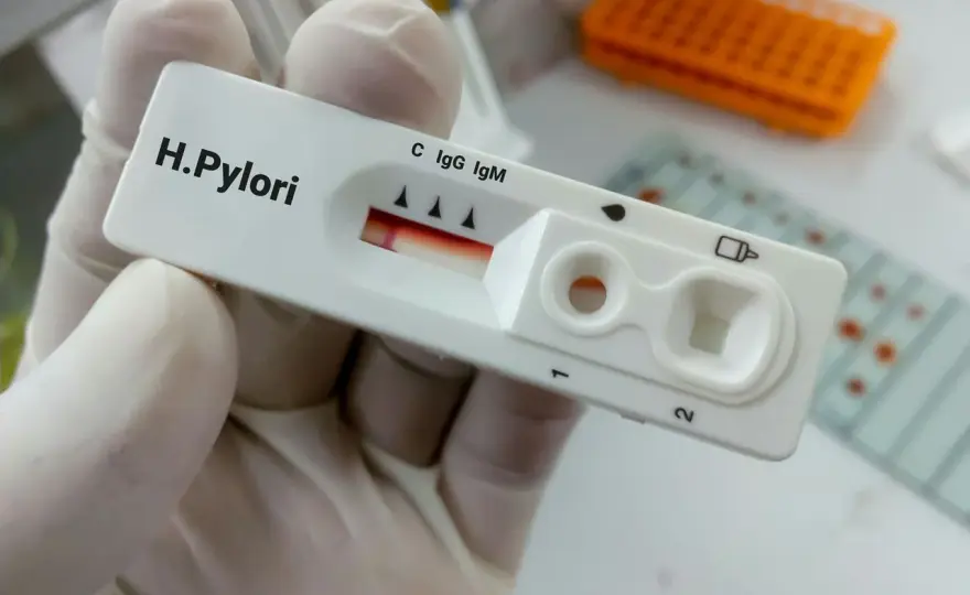 Opinie o leczeniu Helicobacter pylori: Forum dyskusyjne