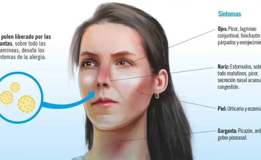 Alergia al polen - cómo reconocer síntomas y respirar mejor