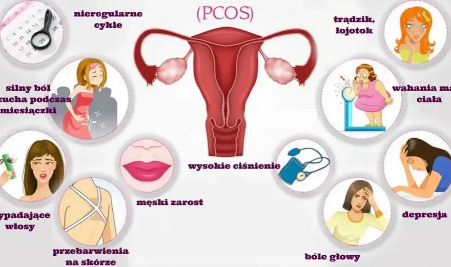 PCO syndrom co to jest - objawy, diagnoza i skutki zdrowotne