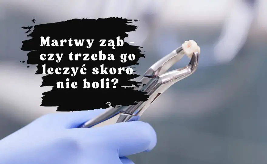 Bolący ząb? Natychmiastowa ulga i sygnały, by iść do dentysty.