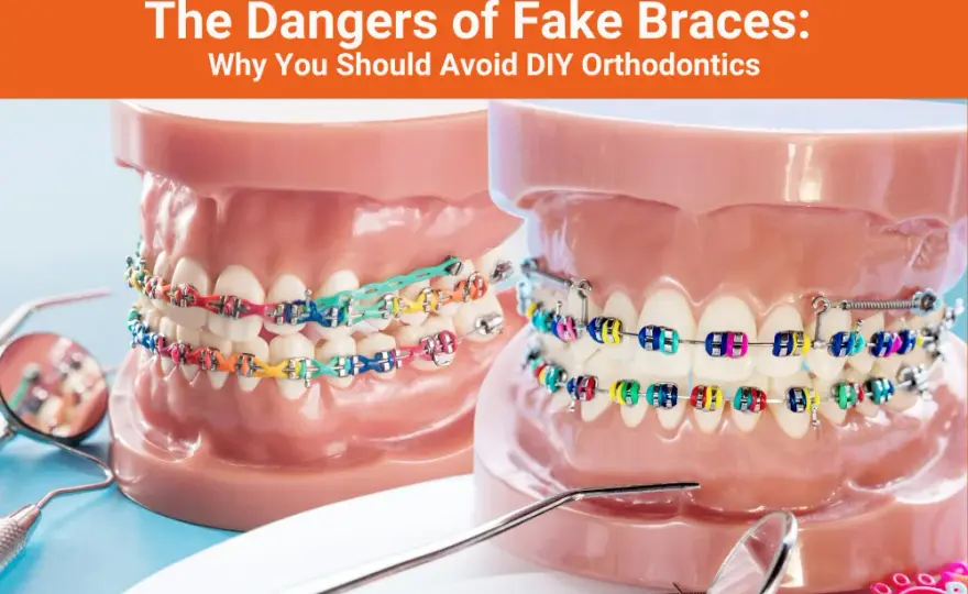 Fake braces: Jak zrobić i dlaczego to zły pomysł?