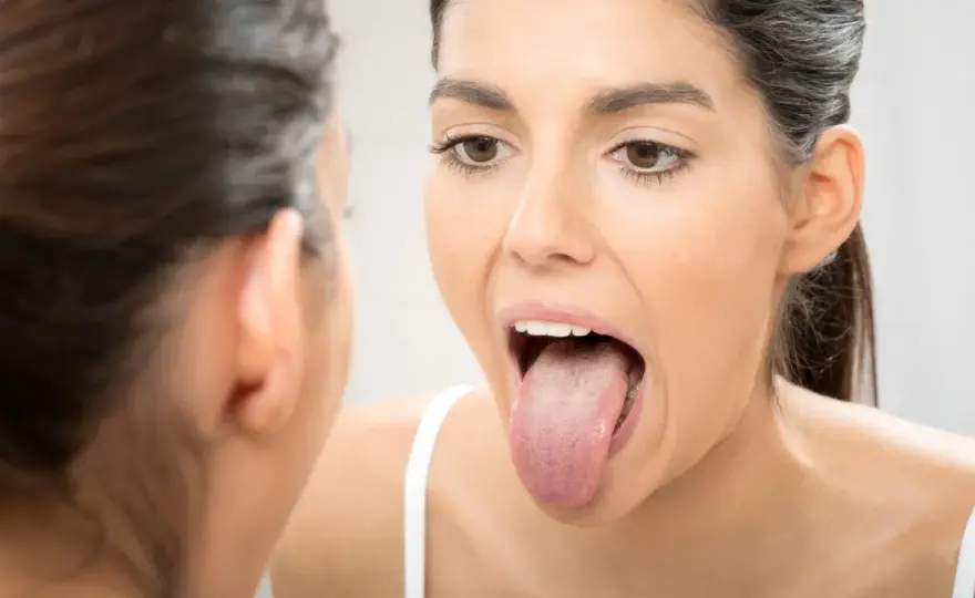 Lengua sana - cómo es y cuándo consultar al dentista