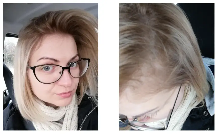 Farba do włosów nie chwyta? Oto dlaczego i jak to naprawić!