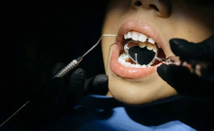Muela rota al masticar sin dolor - causas y qué hacer