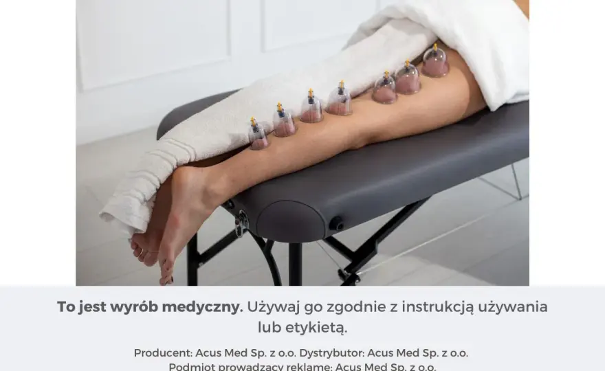 Ból kolana? Jak postawić bańki na kolanie bezpiecznie - poradnik
