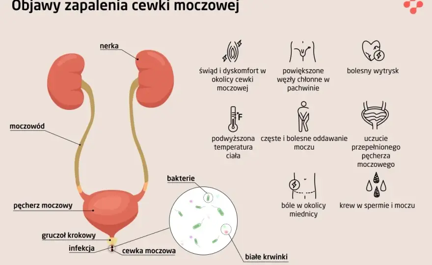 Cewka moczowa - pieczenie, ból, słaby strumień? Co to znaczy?