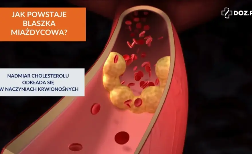 Cholesterol całkowity 220: Granica, sygnał, czy zagrożenie?
