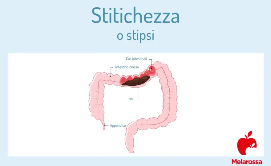 Stitichezza, cosa fare per evacuare e quando chiedere aiuto