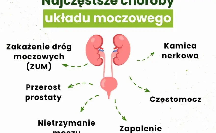 Przyczyny zapalenia pęcherza moczowego: co musisz wiedzieć, aby uniknąć problemów