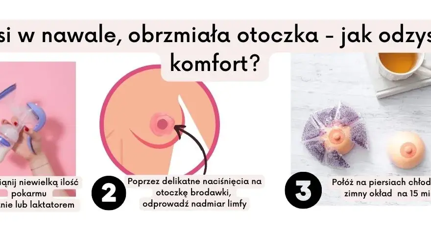 Nawał pokarmu po porodzie - skuteczne sposoby na ulgę i wygodne karmienie