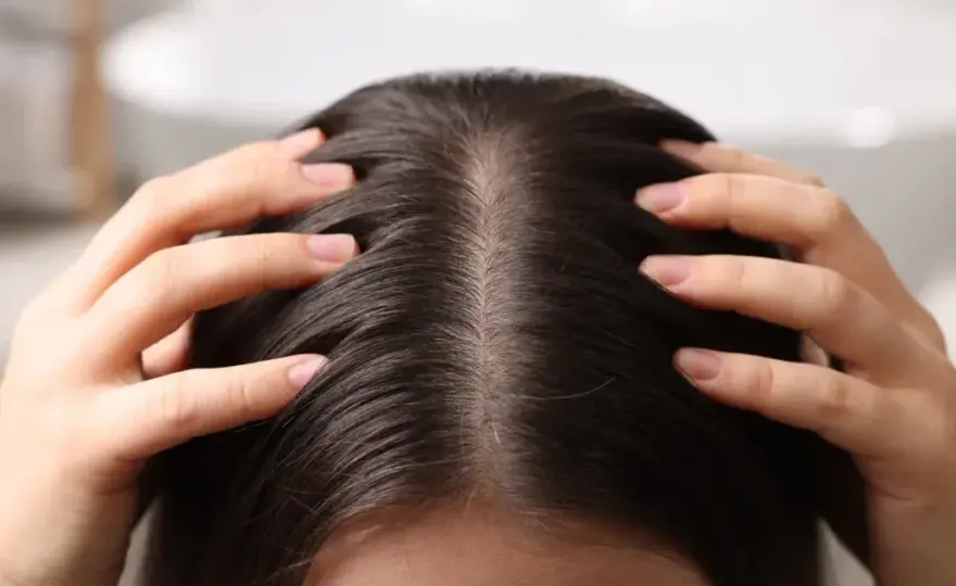 Peeling enzymatyczny do skóry głowy jak używać, by uniknąć problemów z łupieżem