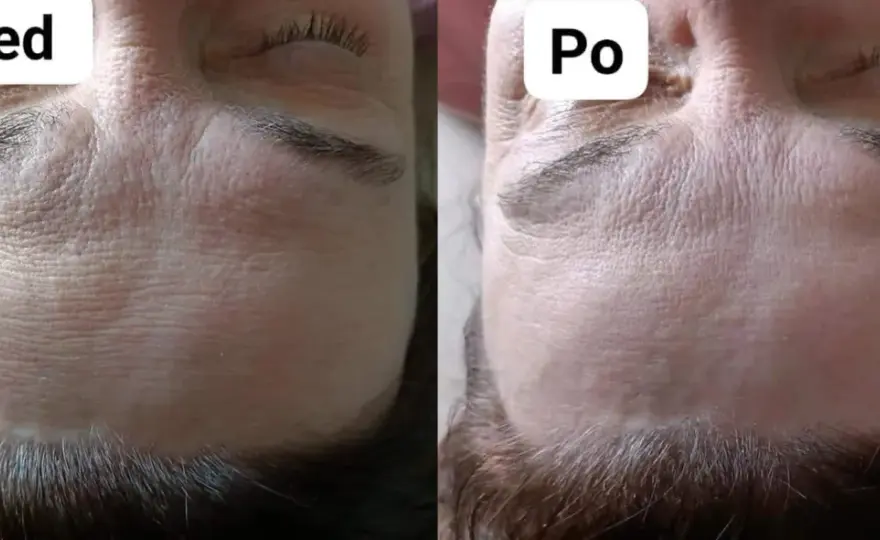 Zoga Face Integration - efekty, cena, porównanie. Warto?