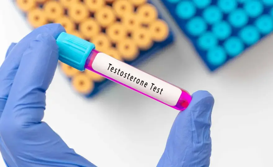 Testosteron bez recepty w jakim kraju? Sprawdź, gdzie jest dostępny