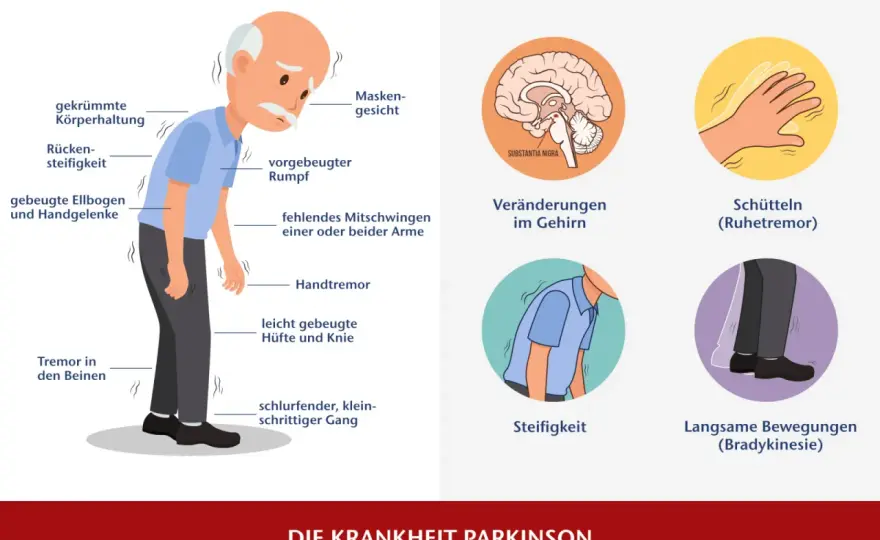 Die entscheidenden Schritte zur Parkinson Diagnostik verstehen