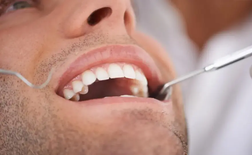 Ból zęba przed dentystą? Jakie leki są bezpieczne, a czego unikać?