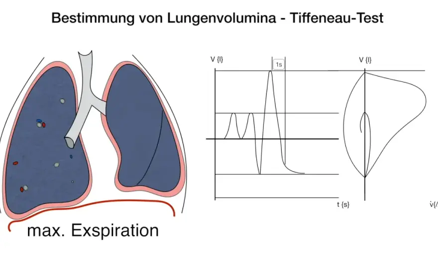 Tiffeneau-Index verstehen - Grenzwerte und Aussagekraft