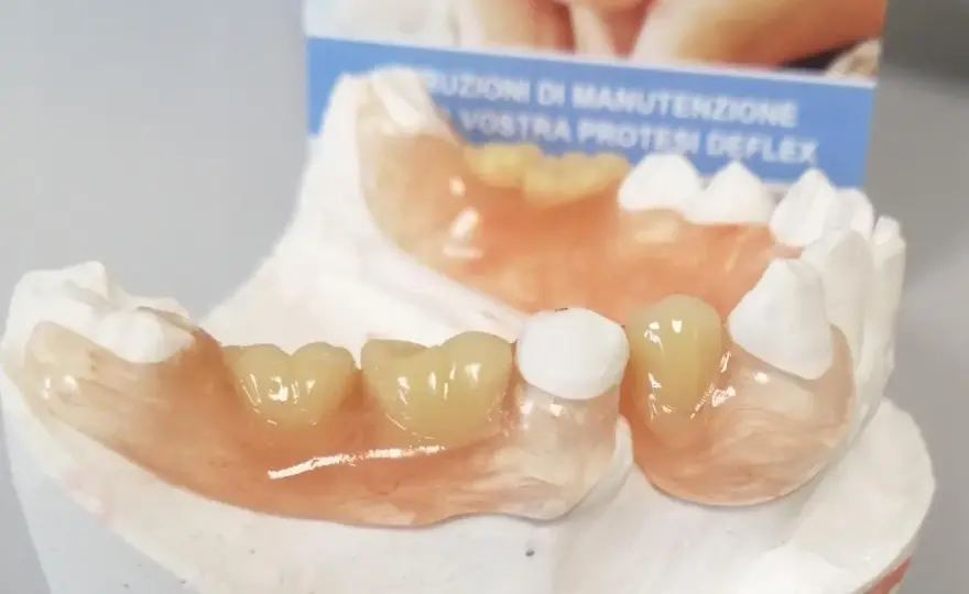 Protesi flessibile Deflex: costi, vantaggi e quando conviene