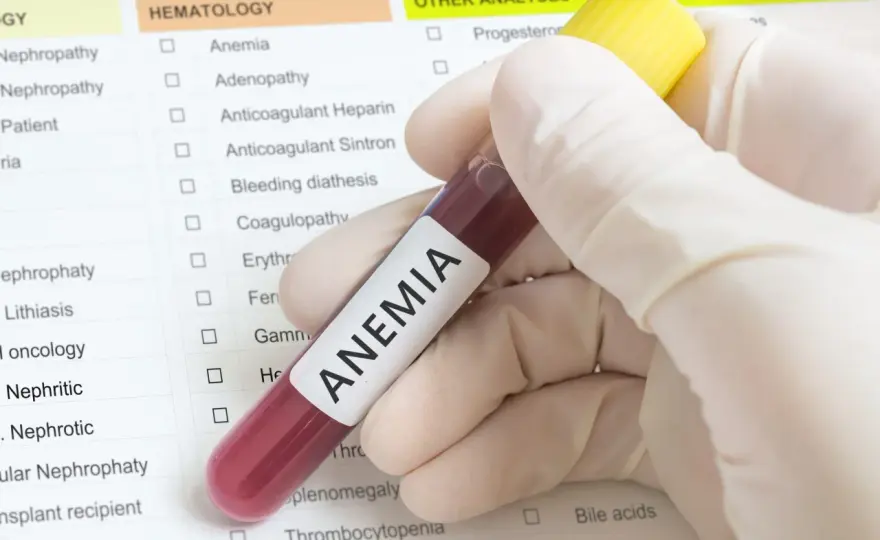 Jakie badania na anemię: Jakie testy są niezbędne do diagnozy?