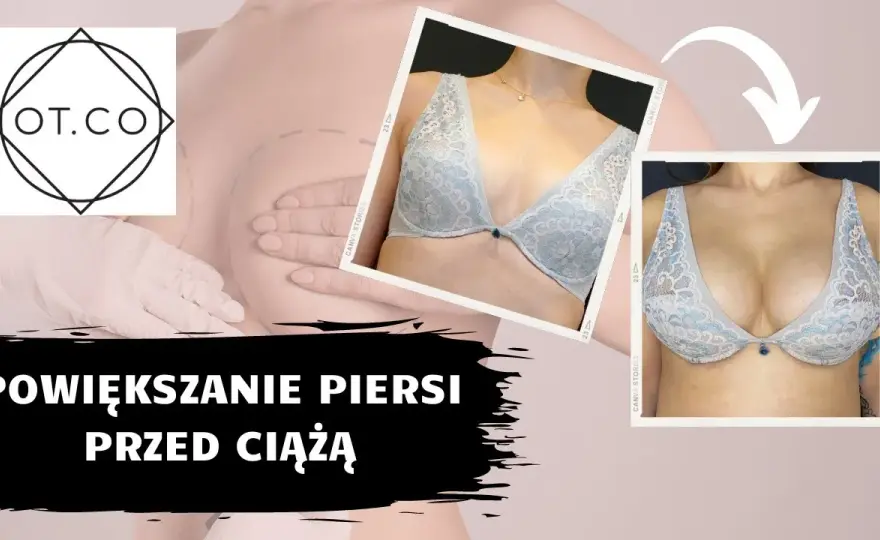 Naturalne powiększanie biustu: Fakty, mity i co naprawdę działa?