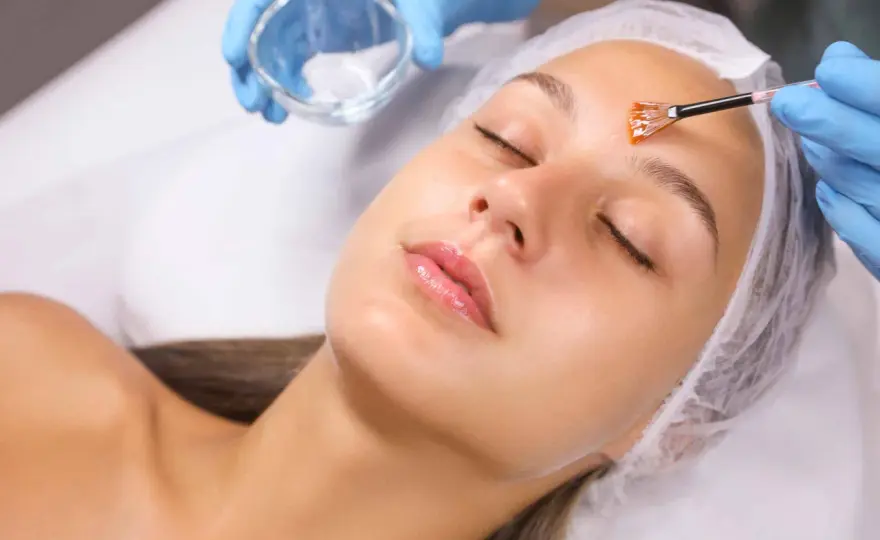 Peeling químico facial - ¿Qué mejora realmente y cuánto cuesta?