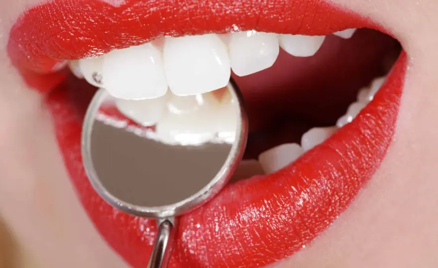 ¿Cuánto dura un empaste pequeño? Tiempos y molestias