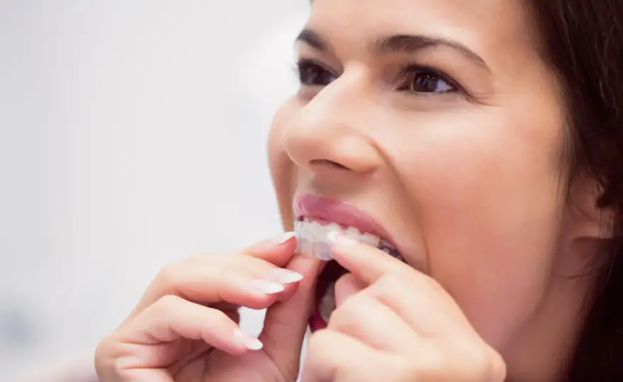 Ortodoncia invisible y periodontitis - cuándo es viable