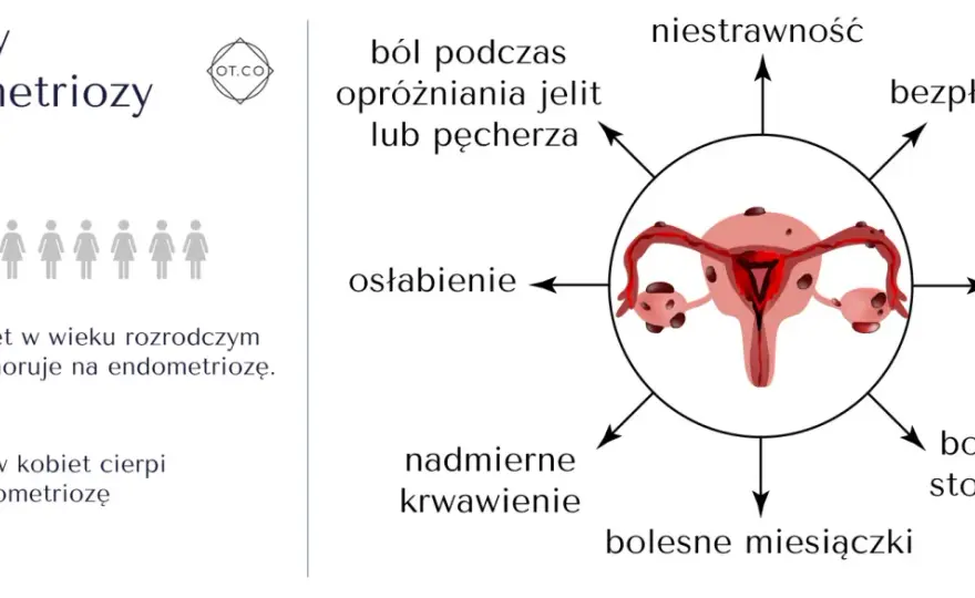 Endometrioza - Czy Twój ból miesiączkowy to coś więcej?
