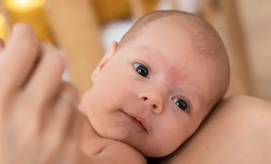 Pelle secca neonato - Quando è normale e come curarla?