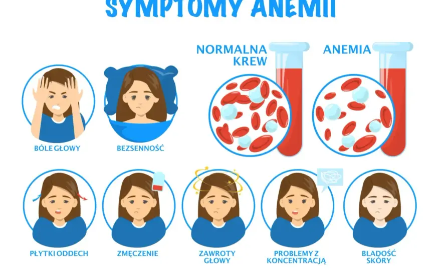 Mgła mózgowa? Niedobór żelaza i jego neurologiczne sygnały