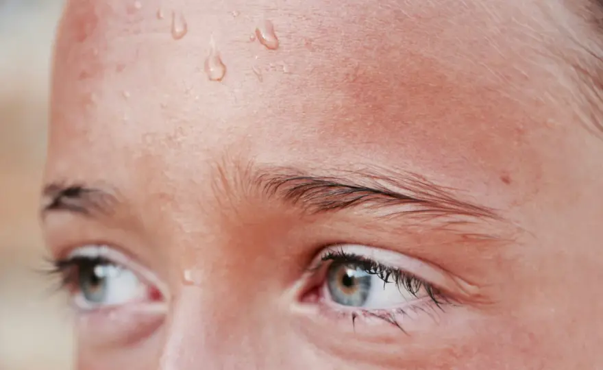 Hiperhidrosis facial - qué la provoca y cómo controlarla