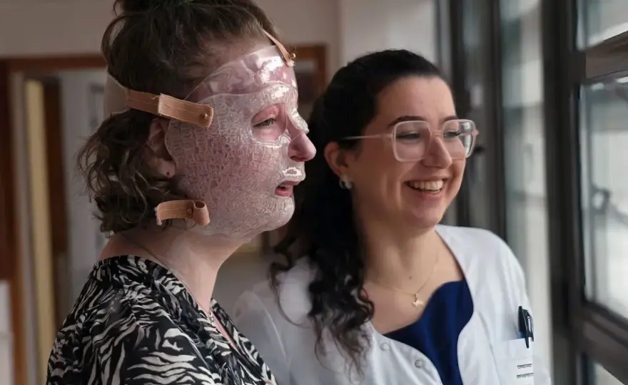 Comment cacher une brûlure sur le visage sans l’irriter ?