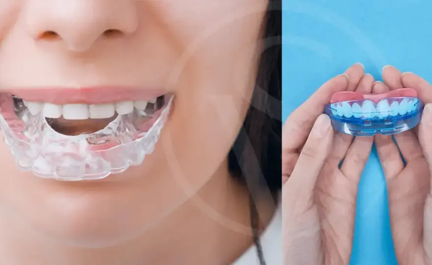 Cómo evitar el bruxismo y proteger tus dientes