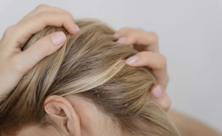 Tea Tree Oil - Usi, benefici e limiti reali per pelle e capelli