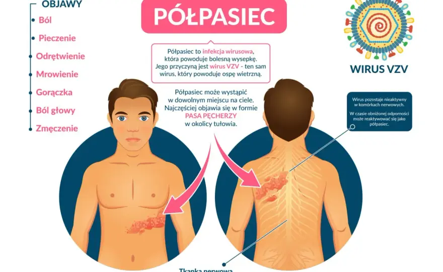 Półpasiec u dziecka - rozpoznaj objawy i wiedz, kiedy działać