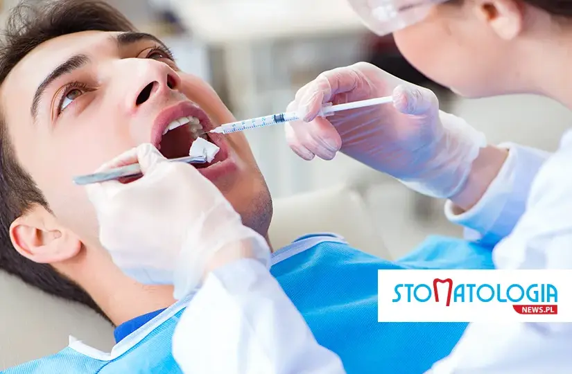 Znieczulenie u dentysty: bez bólu i strachu? Przewodnik eksperta