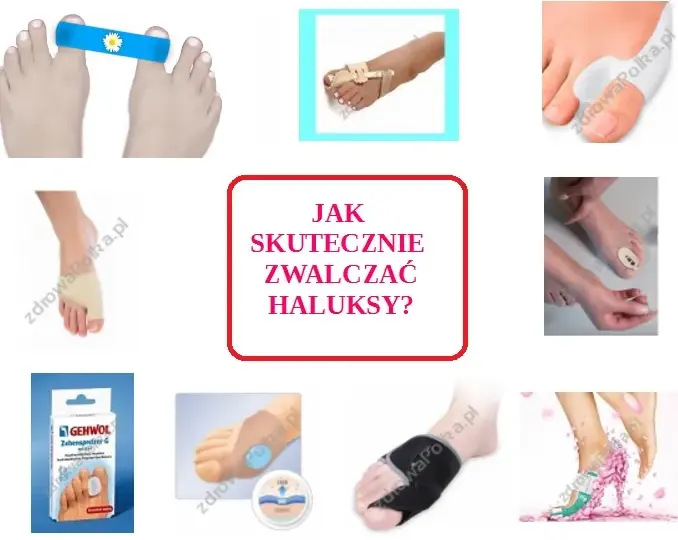 Skuteczna profilaktyka haluksów: Twój przewodnik do zdrowych stóp