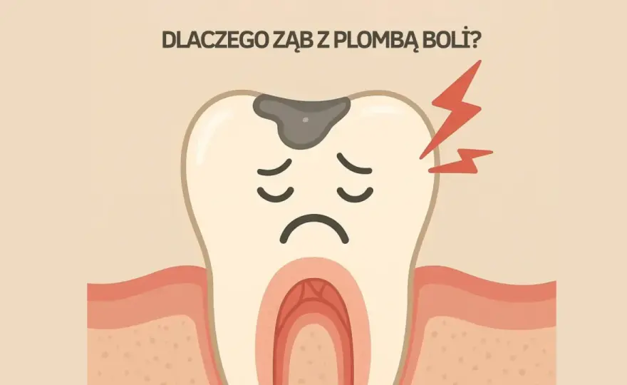 Ból po plombowaniu - kiedy normalny, a kiedy do dentysty?
