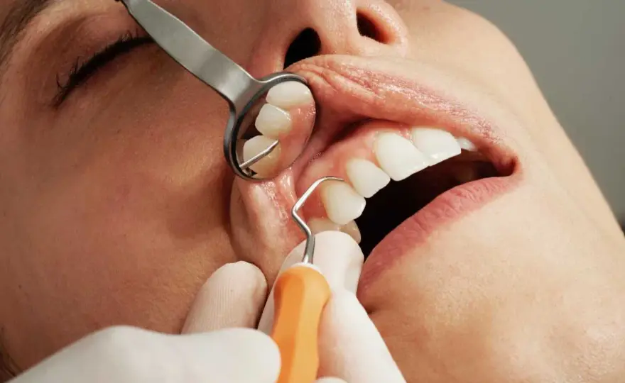Infezione dentale - Segnali, cure e cosa fare subito