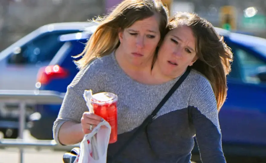 Abby i Brittany Hensel - życie sióstr syjamskich bez tajemnic