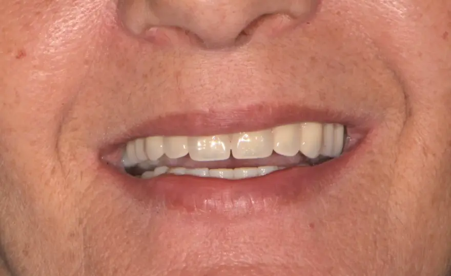 Il tè macchia i denti? Verità e consigli pratici