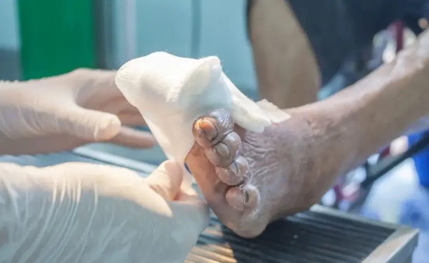 Skuteczne metody na ból neuropatyczny, które przynoszą ulgę