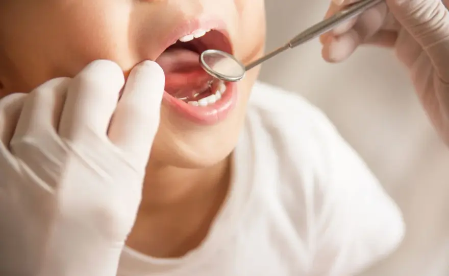 Ipomineralizzazione nei bambini - come proteggere i denti