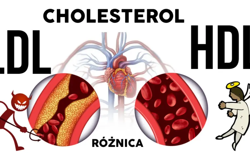 Dobry czy zły cholesterol? Rozróżnij HDL i LDL i zadbaj o serce!