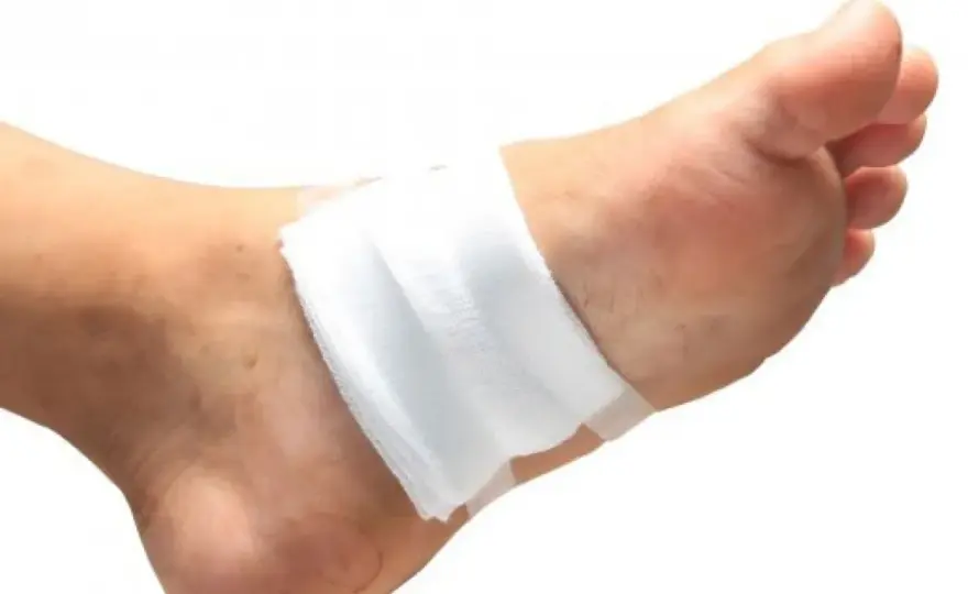 Faut-il mettre un pansement sur une brûlure ?