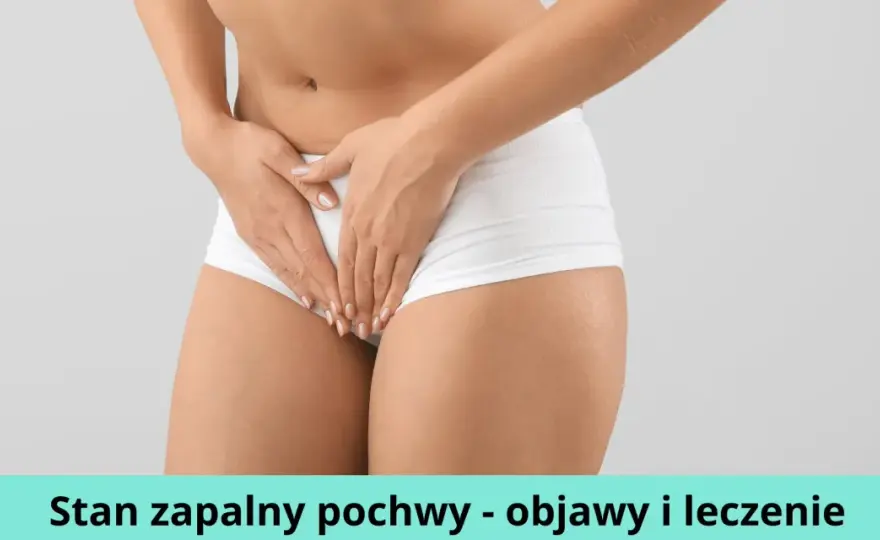 Stan zapalny pochwy: 5 głównych przyczyn i skuteczne leczenie