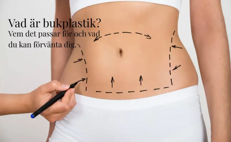 Bukplastik - Allt du behöver veta om operation & resultat