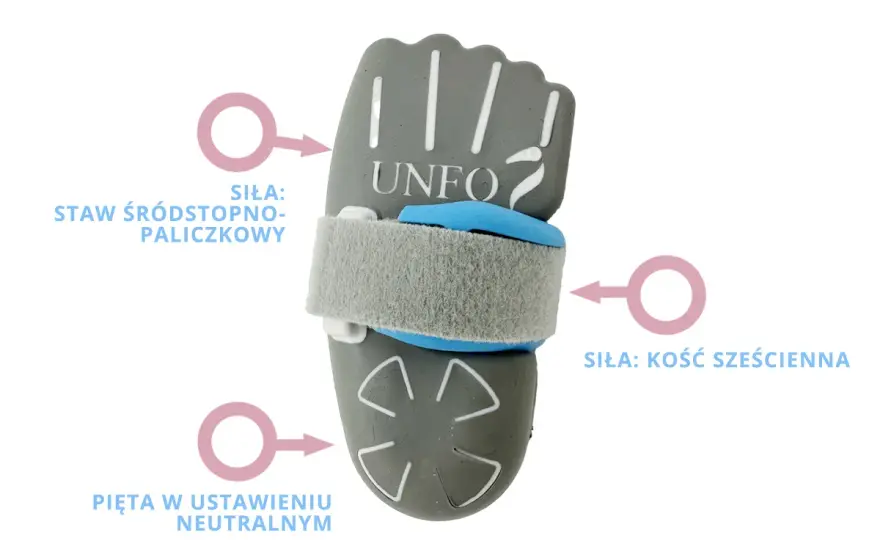 Przywiedzenie przodostopia u niemowląt - Kiedy działać, kiedy obserwować?