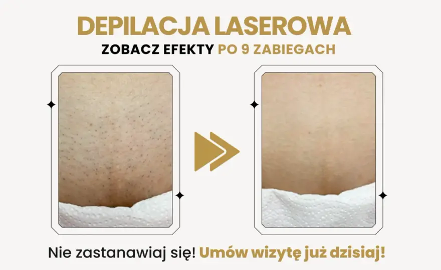 Czym depilować bikini? Wybierz metodę idealną dla siebie!
